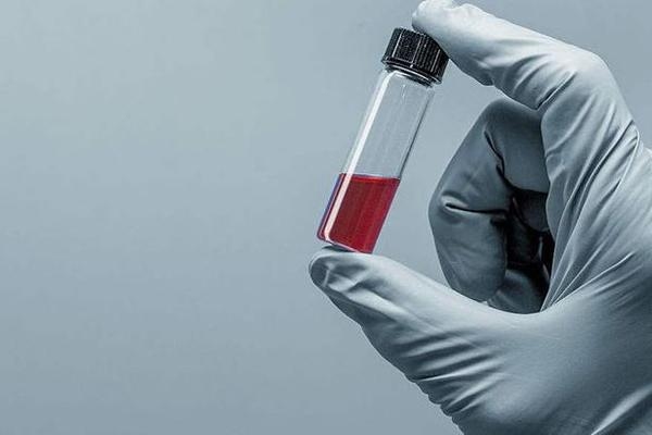 加固材料性能指標(biāo)標(biāo)準(zhǔn)，加固材料性能指標(biāo)標(biāo)準(zhǔn) 行業(yè)新聞 第3張