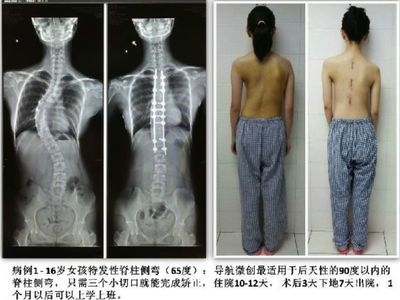 加固效果評估的實際案例，加固效果評估的實際案例分析 行業(yè)新聞 第4張