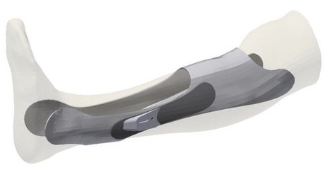 個(gè)性化加固設(shè)計(jì)的軟件工具 行業(yè)新聞 第3張 個(gè)性化加固設(shè)計(jì)的軟件工具 行業(yè)新聞 第3張